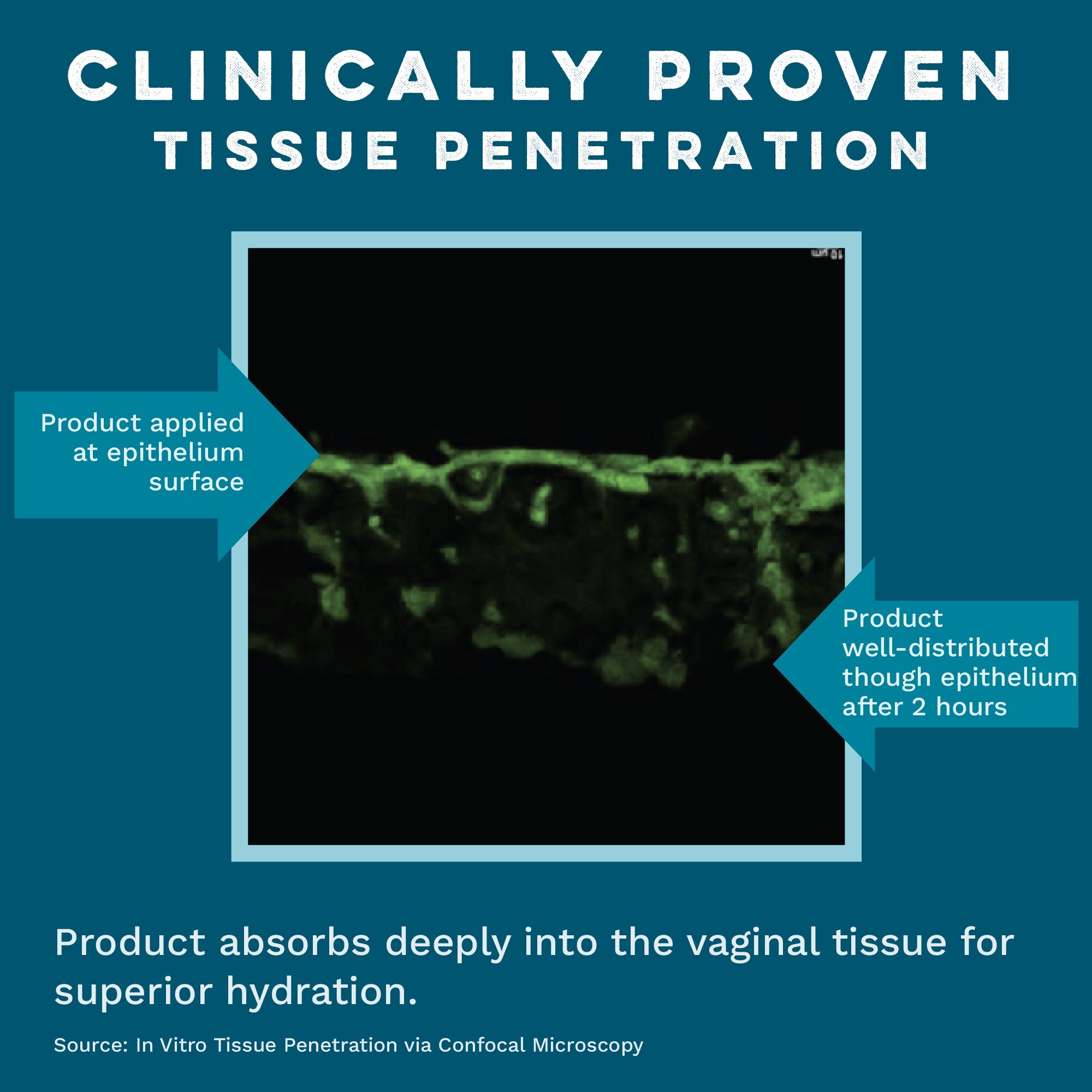 Internal Vaginal Moisturizing Gel for Dryness & Comfort