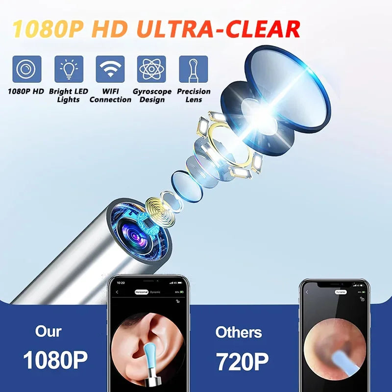 Visual Ear Cleaning Camera, 5MP Otoscope Kit