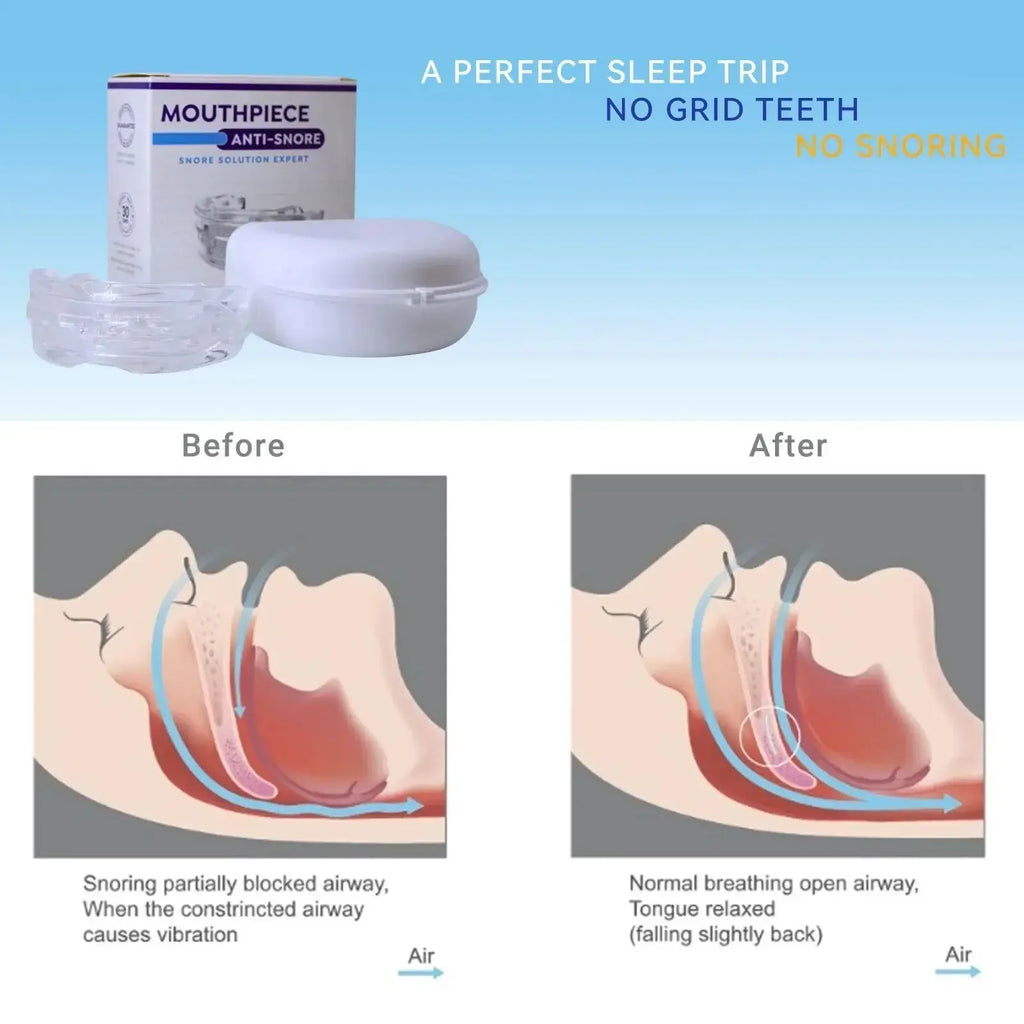 Adjustable Comfort Night Mouthguard, BPA-Free